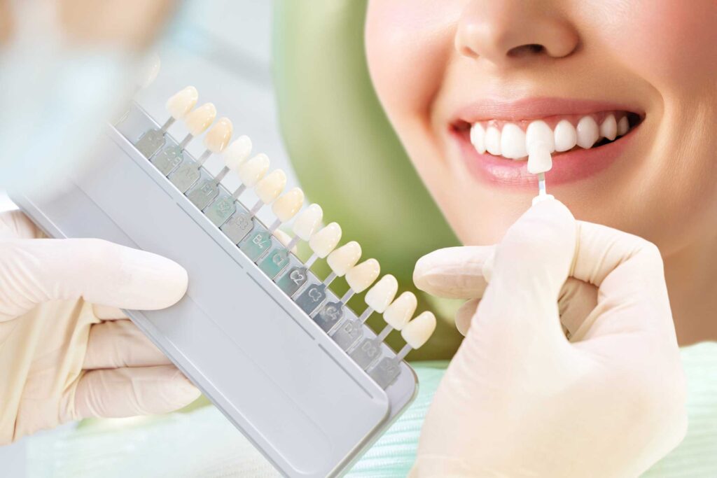 estética dental en Cartagena, Murcia; odontología estética en Cartagena, Murcia.