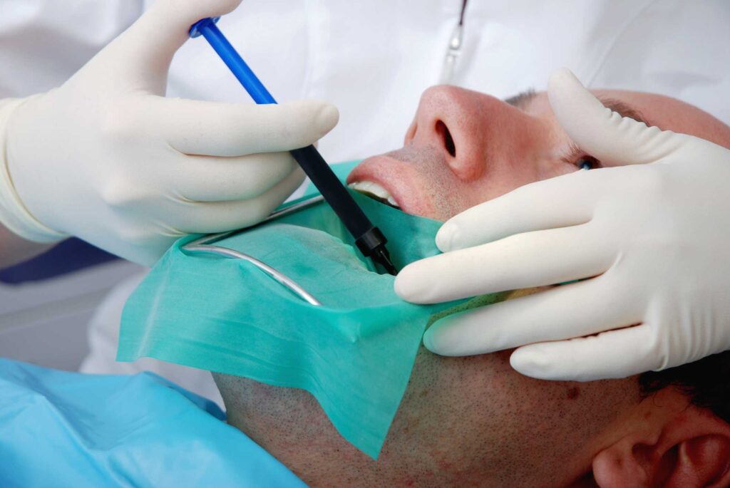 endodoncia en Cartagena, Murcia; Endodoncia microscópica en Cartagena, Murcia; tratamiento de conductos en Cartagena, Murcia.